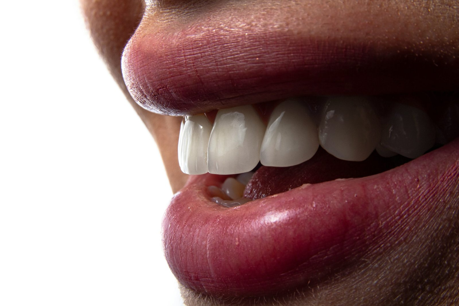 Dental-smile